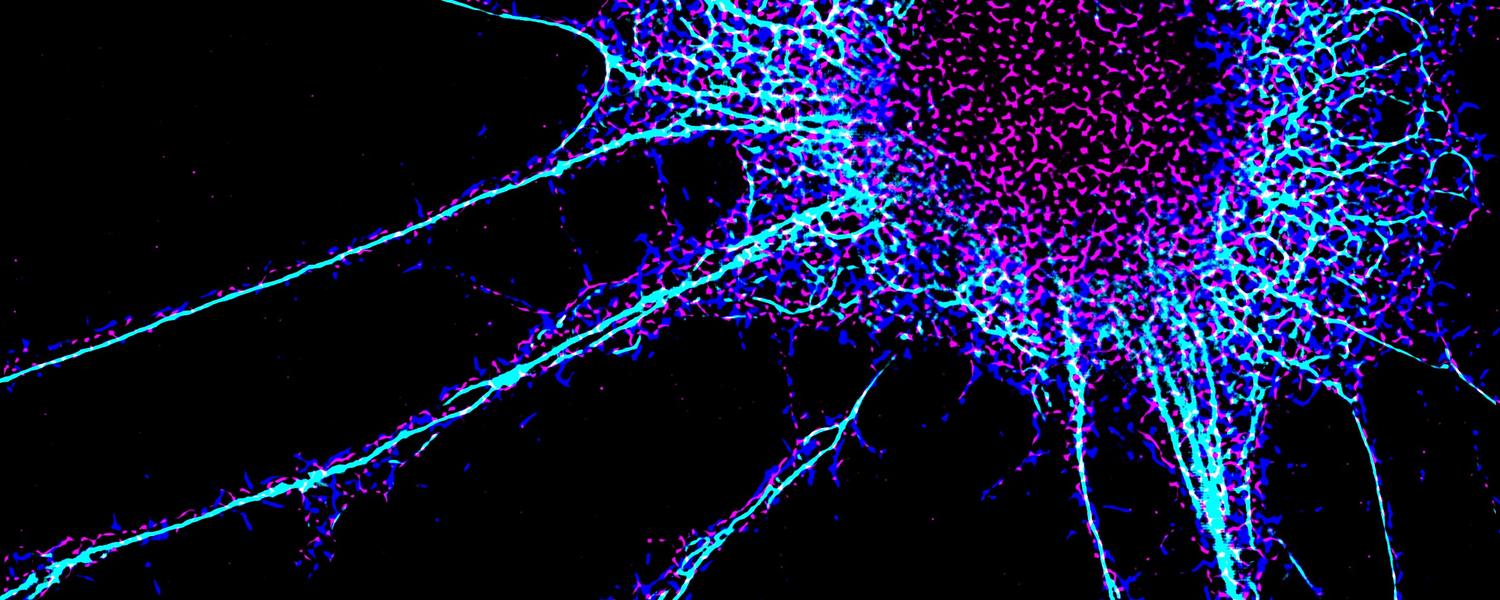 Snyder Institute for Chronic Diseases Biology Diagrams